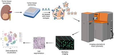 Characterization of papillary and clear cell renal cell carcinoma through imaging mass cytometry reveals distinct immunologic profiles